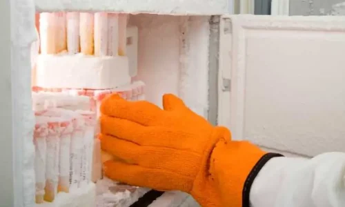 Comprehensive guide to cryopreservation methods and equipment