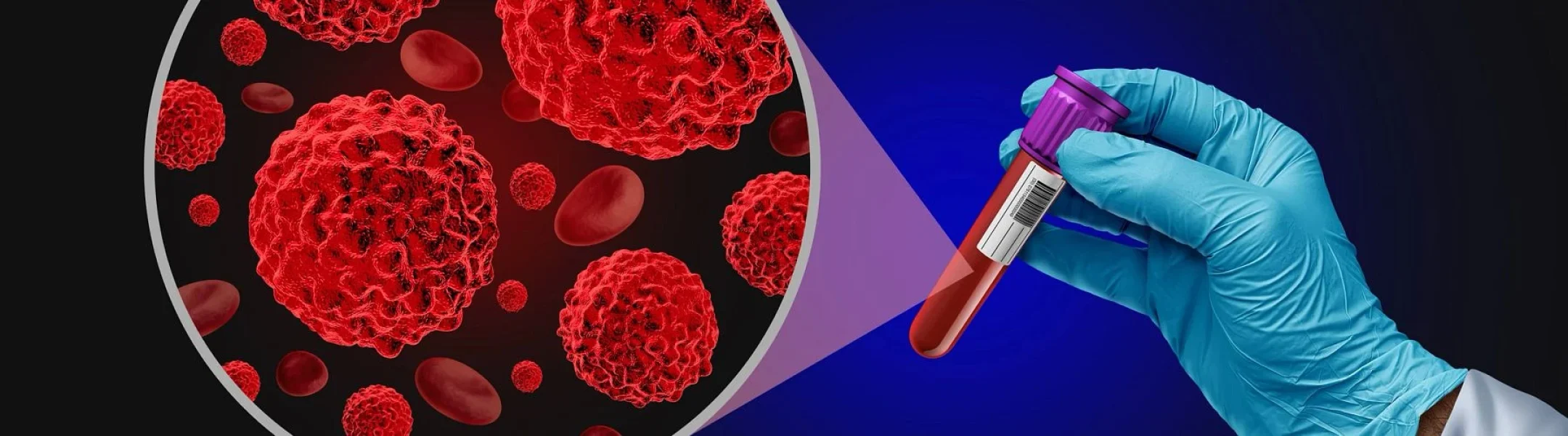 Laboratory professional analyzing blood sample for cancer research and cell analysis