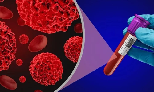 Laboratory professional analyzing blood sample for cancer research and cell analysis